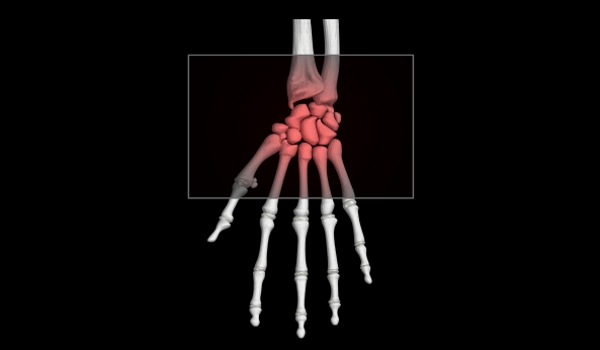 The short bones in your skeletal system